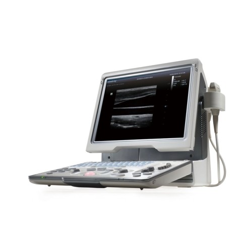УЗИ аппарат Mindray DP-50 - 225 300 руб.