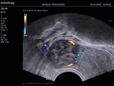 Аппарат ультразвуковой диагностический DC-40 - 380 900 руб.