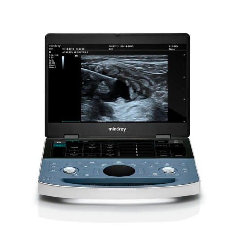 УЗИ аппарат Mindray ME7 - 0 руб.