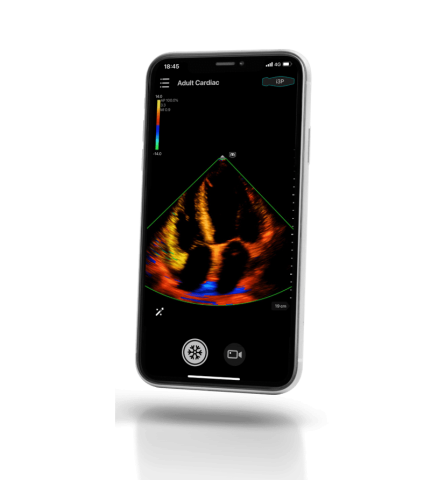 УЗИ сканер Mindray TE Air i3P - 329 800 руб.